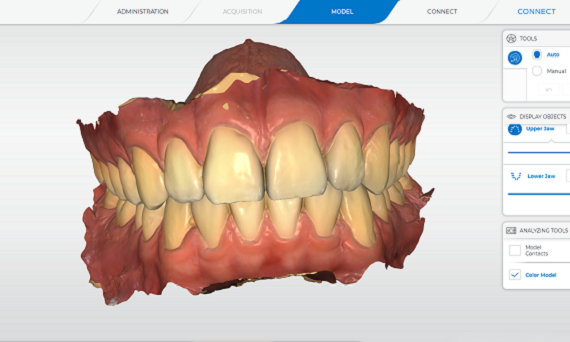 dijital gülüş tasarımı kadıköy – 3D gülüş simülasyonu